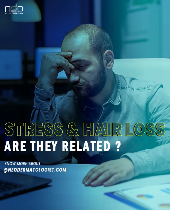 Hair loss and stress  